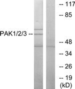 PAK1/2/3 Antibody in Western Blot (WB)