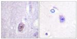 Phospho-SP1 (Thr453) Antibody in Immunohistochemistry (Paraffin) (IHC (P))