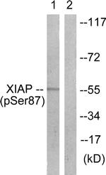 Phospho-XIAP (Ser87) Antibody in Western Blot (WB)