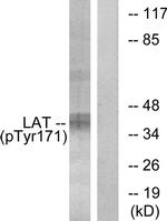 Phospho-LAT (Tyr171) Antibody in Western Blot (WB)