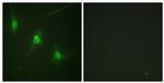 Phospho-MSK1 (Ser360) Antibody in Immunocytochemistry (ICC/IF)