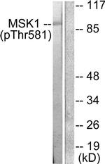 Phospho-MSK1 (Thr581) Antibody in Western Blot (WB)