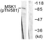 MSK1 Antibody in Western Blot (WB)