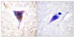 Phospho-mTOR (Ser2481) Antibody in Immunohistochemistry (Paraffin) (IHC (P))