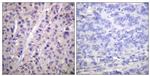 Phospho-A-Raf (Tyr302) Antibody in Immunohistochemistry (Paraffin) (IHC (P))