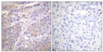 Phospho-GAB1 (Tyr659) Antibody in Immunohistochemistry (Paraffin) (IHC (P))