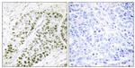 Phospho-ATF2 (Ser480) Antibody in Immunohistochemistry (Paraffin) (IHC (P))