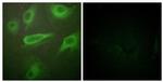 Phospho-IL4R (Tyr497) Antibody in Immunocytochemistry (ICC/IF)