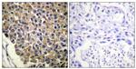 Phospho-CXCR2 (Ser347) Antibody in Immunohistochemistry (Paraffin) (IHC (P))