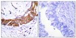 Phospho-IRAK1 (Thr100) Antibody in Immunohistochemistry (Paraffin) (IHC (P))