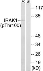 Phospho-IRAK1 (Thr100) Antibody in Western Blot (WB)