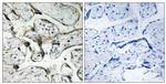 PAK1/PAK2 Antibody in Immunohistochemistry (Paraffin) (IHC (P))