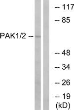 PAK1/PAK2 Antibody in Western Blot (WB)