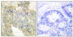 Phospho-Desmin (Ser60) Antibody in Immunohistochemistry (Paraffin) (IHC (P))