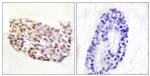 NFAT5 Antibody in Immunohistochemistry (Paraffin) (IHC (P))