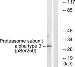 Phospho-PSMA3 (Ser250) Antibody in Western Blot (WB)