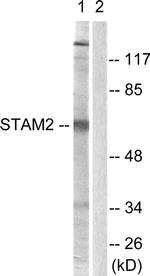 STAM2 Antibody in Western Blot (WB)