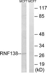 RNF138 Antibody in Western Blot (WB)