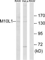 MOV10L1 Antibody in Western Blot (WB)