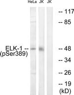 Phospho-ELK1 (Ser389) Antibody in Western Blot (WB)