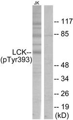 Phospho-LCK (Tyr394) Antibody in Western Blot (WB)