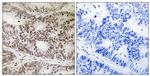 Phospho-STAT2 (Tyr631) Antibody in Immunohistochemistry (Paraffin) (IHC (P))