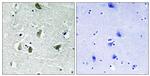 Phospho-JAK2 (Tyr931) Antibody in Immunohistochemistry (Paraffin) (IHC (P))