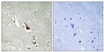 Phospho-TAK1 (Ser439) Antibody in Immunohistochemistry (Paraffin) (IHC (P))