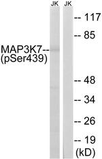 Phospho-TAK1 (Ser439) Antibody in Western Blot (WB)