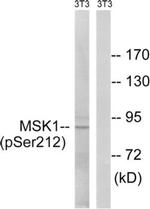 Phospho-MSK1 (Ser212) Antibody in Western Blot (WB)