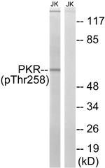 Phospho-PKR (Thr258) Antibody in Western Blot (WB)