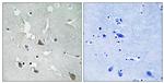 Phospho-TIRAP (Tyr86) Antibody in Immunohistochemistry (Paraffin) (IHC (P))