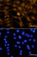 OTX2 Antibody in Immunocytochemistry (ICC/IF)