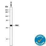 OTX2 Antibody in Western Blot (WB)