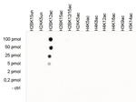 H2BK12ac Antibody