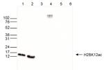 H2BK12ac Antibody in Western Blot (WB)