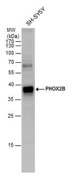 PHOX2B Antibody in Western Blot (WB)