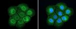 TPR Antibody in Immunocytochemistry (ICC/IF)