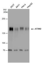 Ataxin 2 Antibody in Western Blot (WB)