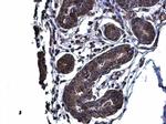 Glutaminase C (GAC) Antibody in Immunohistochemistry (Paraffin) (IHC (P))