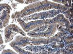 Glutaminase C (GAC) Antibody in Immunohistochemistry (Paraffin) (IHC (P))