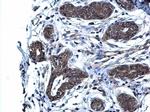 Glutaminase C (GAC) Antibody in Immunohistochemistry (Paraffin) (IHC (P))