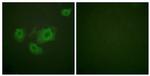 Phospho-Kir6.2 (Thr224) Antibody in Immunocytochemistry (ICC/IF)