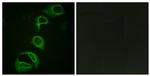 Phospho-ALK (Tyr1604) Antibody in Immunocytochemistry (ICC/IF)