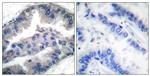 Phospho-BIK (Thr33) Antibody in Immunohistochemistry (Paraffin) (IHC (P))