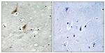 Phospho-MSK2 (Thr568) Antibody in Immunohistochemistry (Paraffin) (IHC (P))