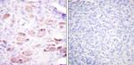 Phospho-DAXX (Ser668) Antibody in Immunohistochemistry (Paraffin) (IHC (P))