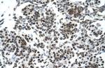 ZNF394 Antibody in Immunohistochemistry (Paraffin) (IHC (P))