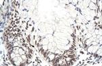 ZNF394 Antibody in Immunohistochemistry (Paraffin) (IHC (P))