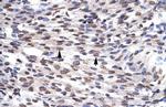 GFI1B Antibody in Immunohistochemistry (Paraffin) (IHC (P))